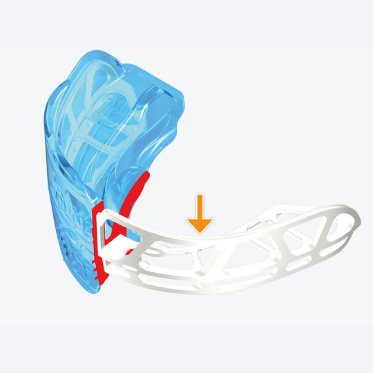 K2 Myobrace® – Gewohnheitskorrektur und Bogenentwicklung für Kinder | Alter 6 – 10