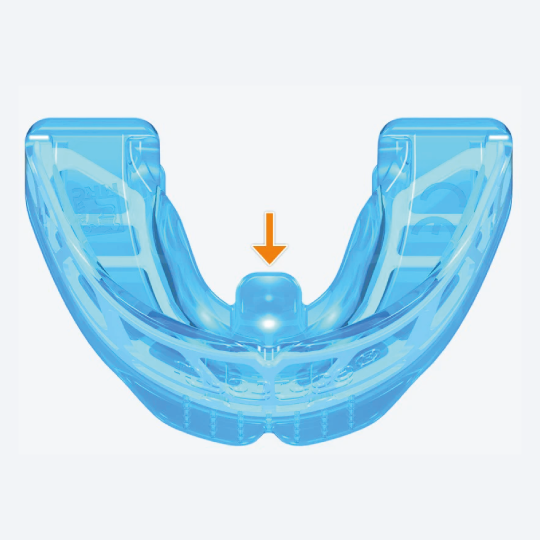K2 Myobrace® – Gewohnheitskorrektur und Bogenentwicklung für Kinder | Alter 6 – 10