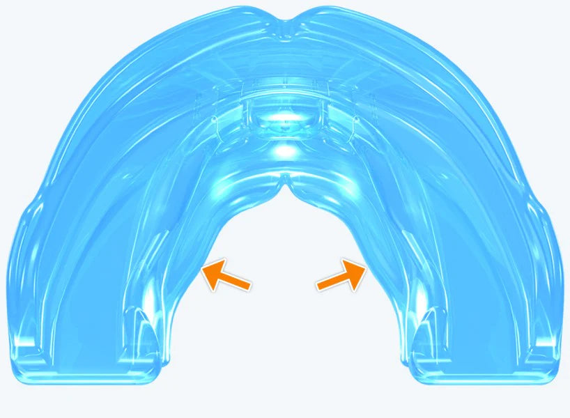 K1 Myobrace® for Kids – the starting point for orthodontic correction