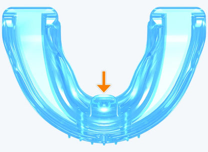 K1 Myobrace® for Kids – the starting point for orthodontic correction