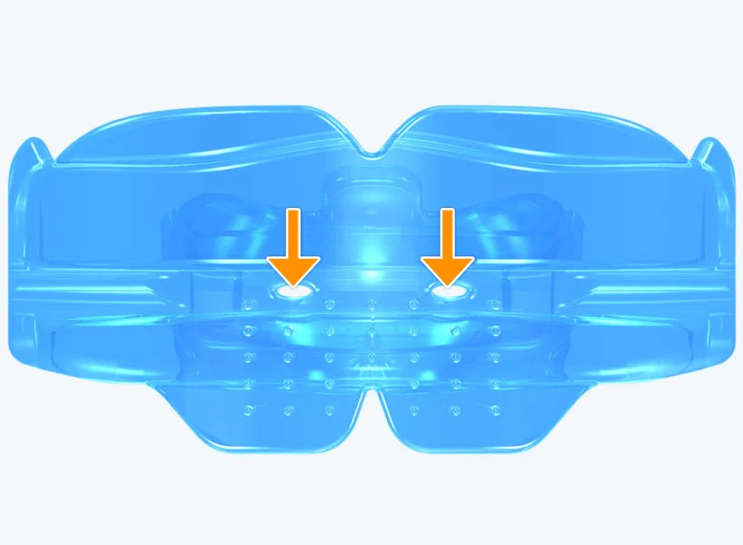 K1 Myobrace® for Kids – the starting point for orthodontic correction