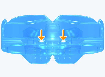 K1 Myobrace® for Kids – the starting point for orthodontic correction